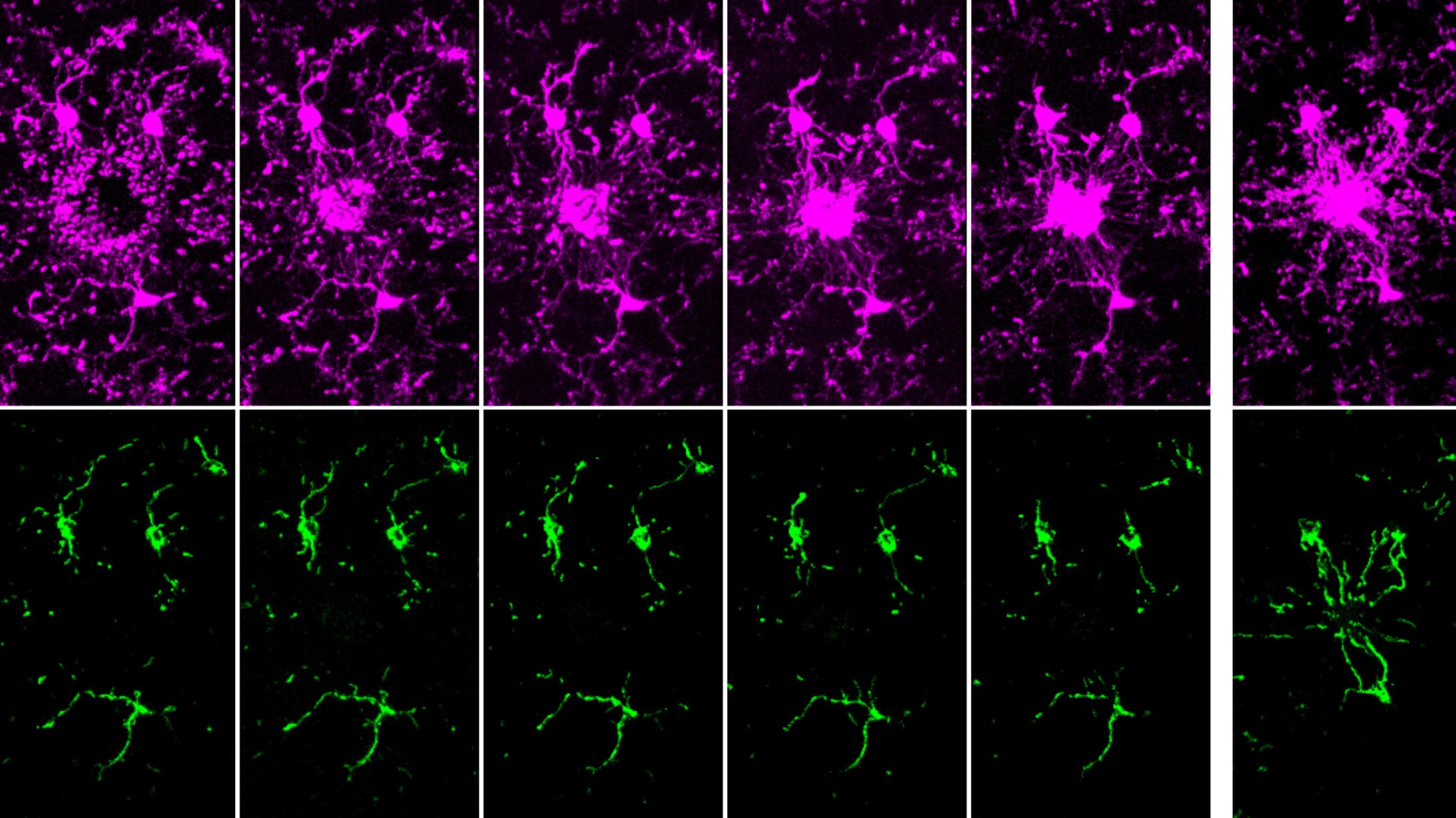 The time series shows how microglia cells (magenta) deploy mitochondria (green) after they detect a nearby injury in the brain. (The series shows five minutes at left and six hours at right.) The researchers showed that microglia cells began probing and assessing the injury within five minutes, but mitochondria were only detectable at the injury site after six hours. (Images courtesy of Robert Hill)
