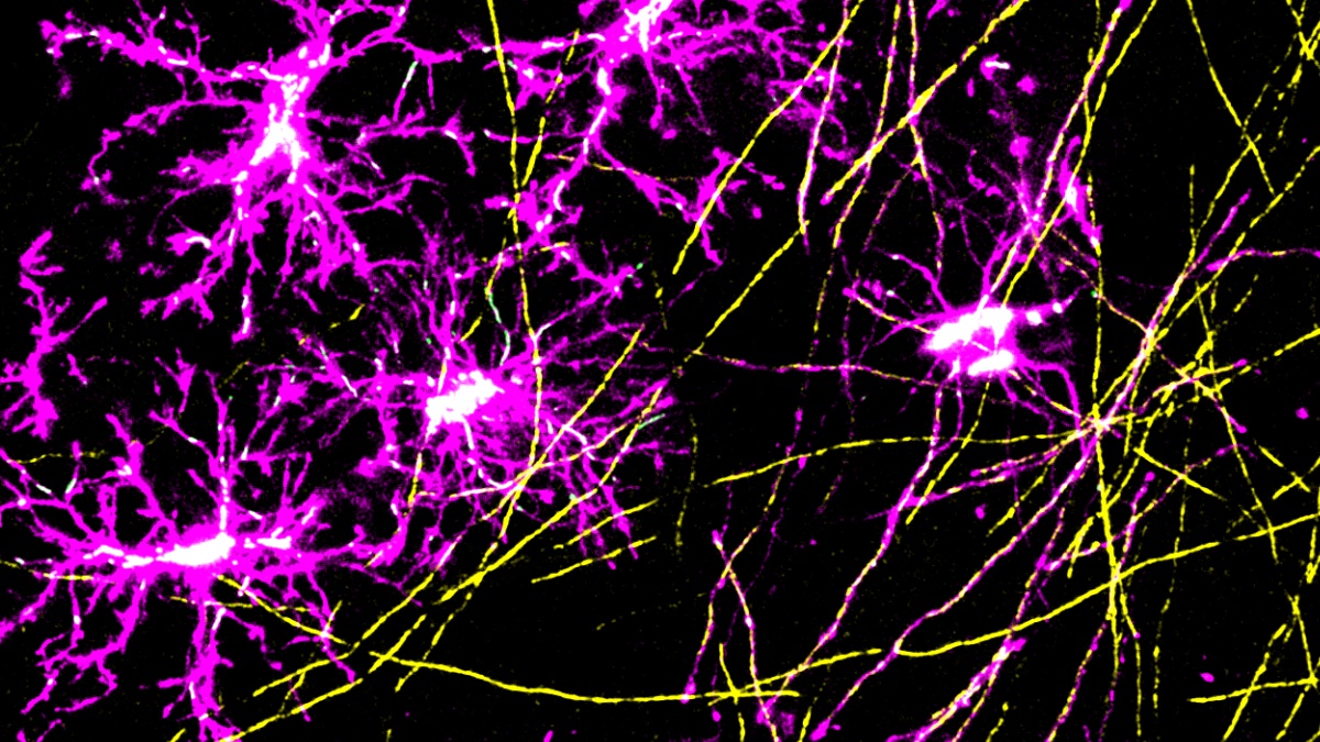 Image captured from the live brain showing mitochondria (green) in different cells of the oligodendrocyte lineage (magenta) with myelin sheaths shown in yellow.