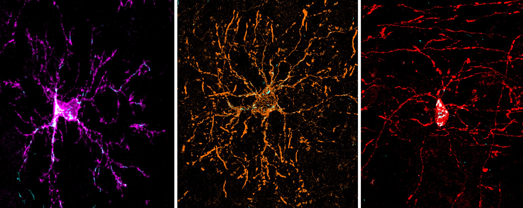 Depictions of mitochondria in an oligodendrocyte precursor cell; newly formed oligodendrocyte; and mature myelinating oligodendrocyte.